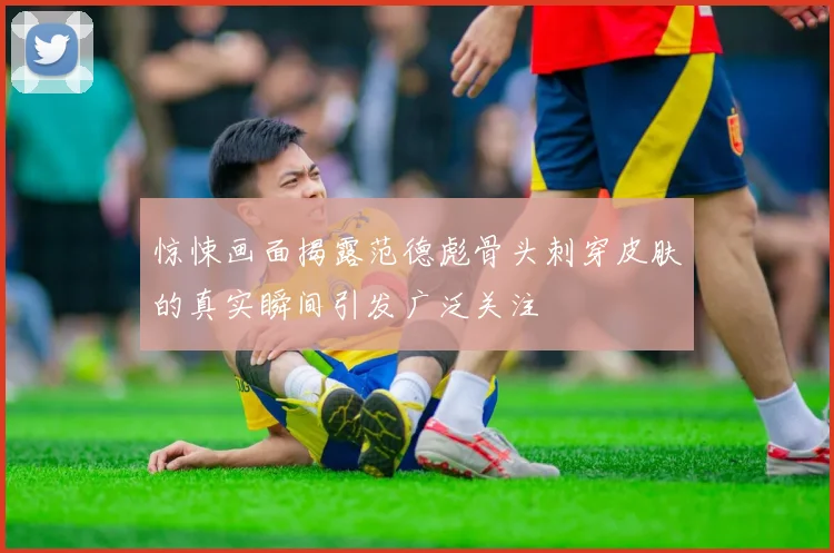惊悚画面揭露范德彪骨头刺穿皮肤的真实瞬间引发广泛关注